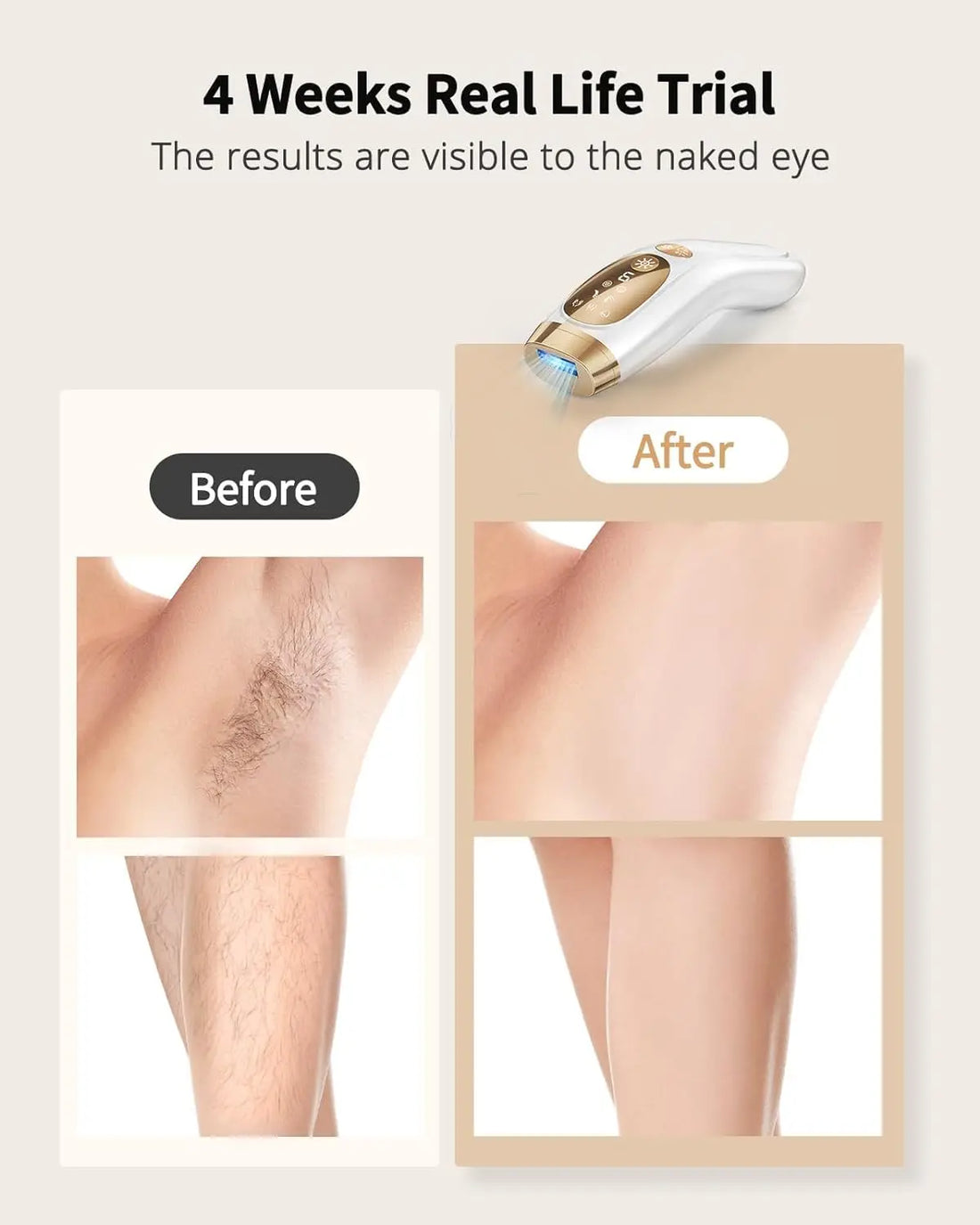 IPL Hair Removal Device - Unlimited Flashes, Ice-Cooling & Painless Whole Body Treatment